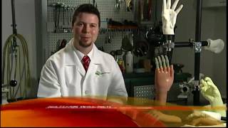 World's First Bionic Fingers