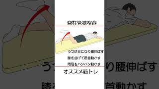 脊柱管狭窄症 しびれが消えるおすすめ体操！ 【医師が解説】