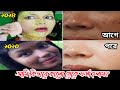 এটা লাগিয়ে কালো থেকে ফর্সা হলাম | My skin whitening home remedies | skin brightening facial