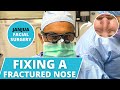 HOW TO FIX A FRACTURED NOSE - DR. TANVEER JANJUA - NEW JERSEY