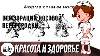 Перфорация носовой перегородки