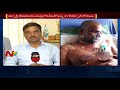 sudhakar reddy acid case doctors face to face on rajesh health condition ntv