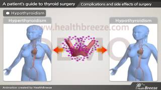 [시연용] c0021acen A patient’s guide to thyroid surgery Papillary Cancer