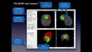 ITK-SNAP 3.2 User Training, Session 3: Image Navigation