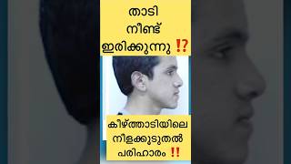 നീണ്ടിരിക്കുന്ന താടി എങ്ങനെ കുറയ്ക്കാം⁉️താടിയെല്ലിന്റെ നീളം കുറയ്ക്കുന്ന ചികിത്സ‼️#orthodontist