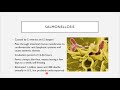 bio 205 chapter 24 digestive system infections