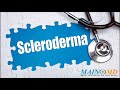 scleroderma ¦ treatment and symptoms