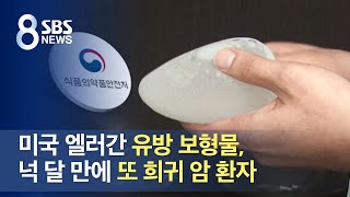 미국 엘러간 유방 보형물, 넉 달 만에 또 희귀 암 환자 / SBS