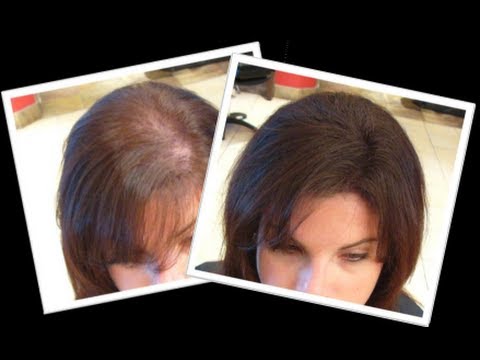 How to: Grow New Hair Naturally within a month How to: Grow New Hair Naturally within a month