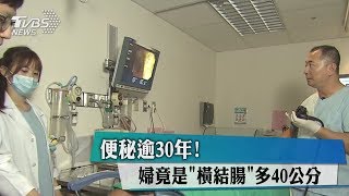 便秘逾30年！　婦竟是「橫結腸」多40公分