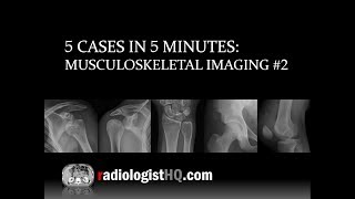 5 Cases in 5 Minutes: Musculoskeletal #2