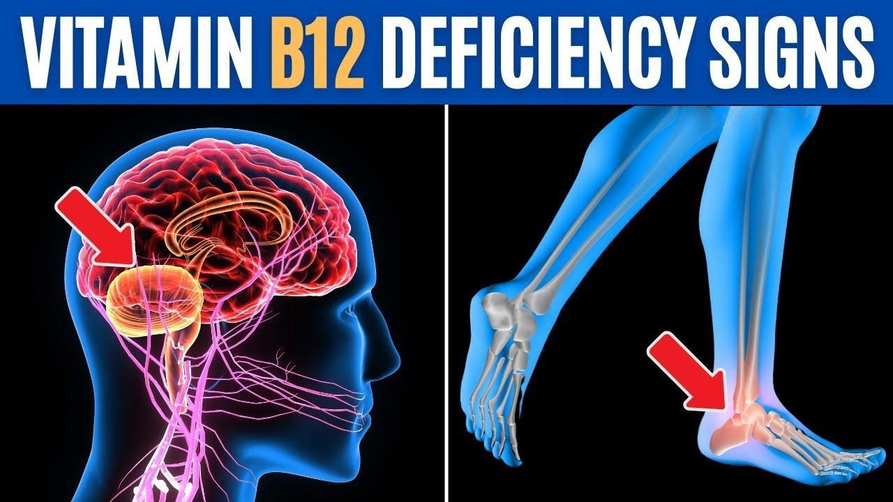 Serious Health Issues Of Vit B12 Deficiency /sign And Symptoms /causes ...