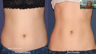 Body Contouring Experts Breakdown the Most Effective Body Sculpting Procedure