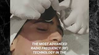 TriPollar® the MOST advanced radio frequency (RF) technology in the industry