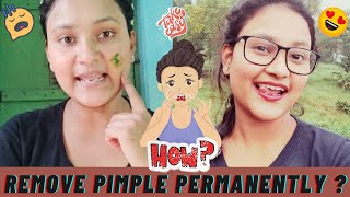 How to remove pimple permanently from face 👩🏻‍💼 || কিভাবে চিরতরে মুখ থেকে পিম্পল দূর করবে🤔🤔#pimple