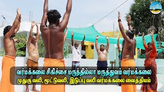 🔴Varmakalai Treatment 🔴முதுகு வலி, மூட்டு வலி மருந்தே இல்லாமல் வர்மக்கலை மூலம் குணமாக்குதல்