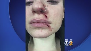 Woman Slashed In NYC