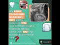 Do you Need a Ceph if you have Invisalign's CBCT Feature?