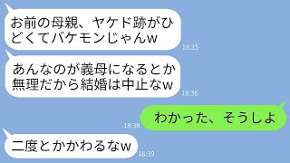 結婚の挨拶で母の顔にヤケドの跡を見た彼氏は、すぐに婚約を解消。「化け物の娘は無理」と言ったが、母の正体を知った時の彼の反応が面白かった。