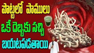 Pin Worm 😱 Nulipurugulu 🥵పొట్టలో పాములు ఒకే దెబ్బకు సచ్చి బయట పడతాయి| Dr Manthena Satyanarayana Raju