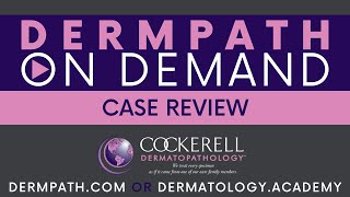 Case Review Episode 19