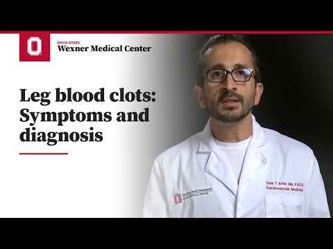 Blood clots in legs: symptoms and diagnosis Blood clots in legs: symptoms and diagnosis