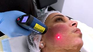 Express Tightening - Full Facial Treatment | Ocean Cosmetics