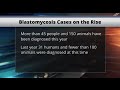 Blastomycosis on the Rise in MN