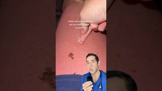 Doctor Reacts: extreme sunburn