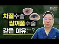 쌍꺼풀 수술과 항문질환 치질 공통점