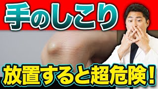 その腫れ、本当にガングリオン？悪性腫瘍との違いを解説【整形外科専門医】