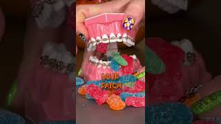 WORST CANDY FOR YOUR TEETH 🦷 AND BRACES / DON'T CHEW JOLLY RANCHERS ASMR CRUNCHY EDITION