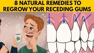👅8 Easy Ways To Grow Back Your Receding Gums Naturally At Home