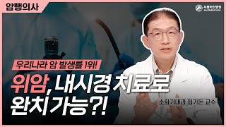 위암, 내시경 치료로 완치할 수 있다!