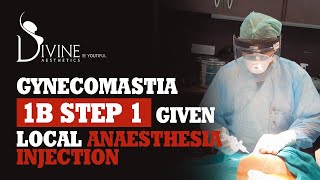 Gynecomastia 1b Step 1 - Given Local Anaesthesia Injection