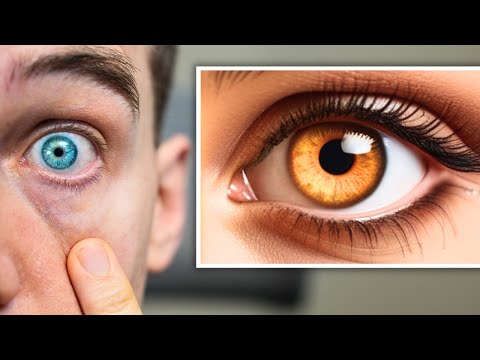 What color eyes do most Scottish have?