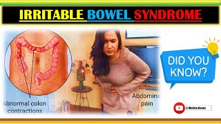 IRRITABLE BOWEL SYNDROME | IBS | CUASES OF IBS | SIGN AND SYMPTOMS OF IBS | TREATMENT OF IBS