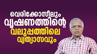 വെരിക്കോസീലും വൃഷണത്തിന്റെ വലുപ്പത്തിലെ വ്യത്യാസവും | Varicocele and Variation in Testicular Size