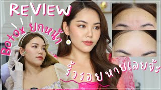 REVIEW: จัดเต็ม BOTOX ยกกรอบหน้าสุดปัง ริ้วรอยหายเกลี้ยง | Wonderpeach