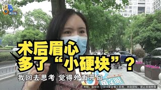 【1818黄金眼】花2万多做鼻子眼部综合整形，眉心多了“小硬块”