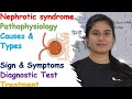 Nephrotic Syndrome | Types | Pathophysiology | Symptoms | Causes | Diagnose | Treatment