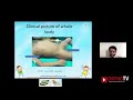 orthotv original skeletal xrays in pediatric orthopaedics dr mandar agashe