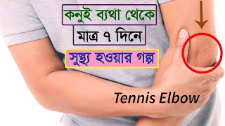 কনুই ব্যথার চিকিৎসা মাত্র 7 দিনে-Treatment of Tennis elbow pain in just 7 days