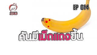 คันจู๋ มีเม็ดแดงขึ้น - ชูรักชูรส ep 014