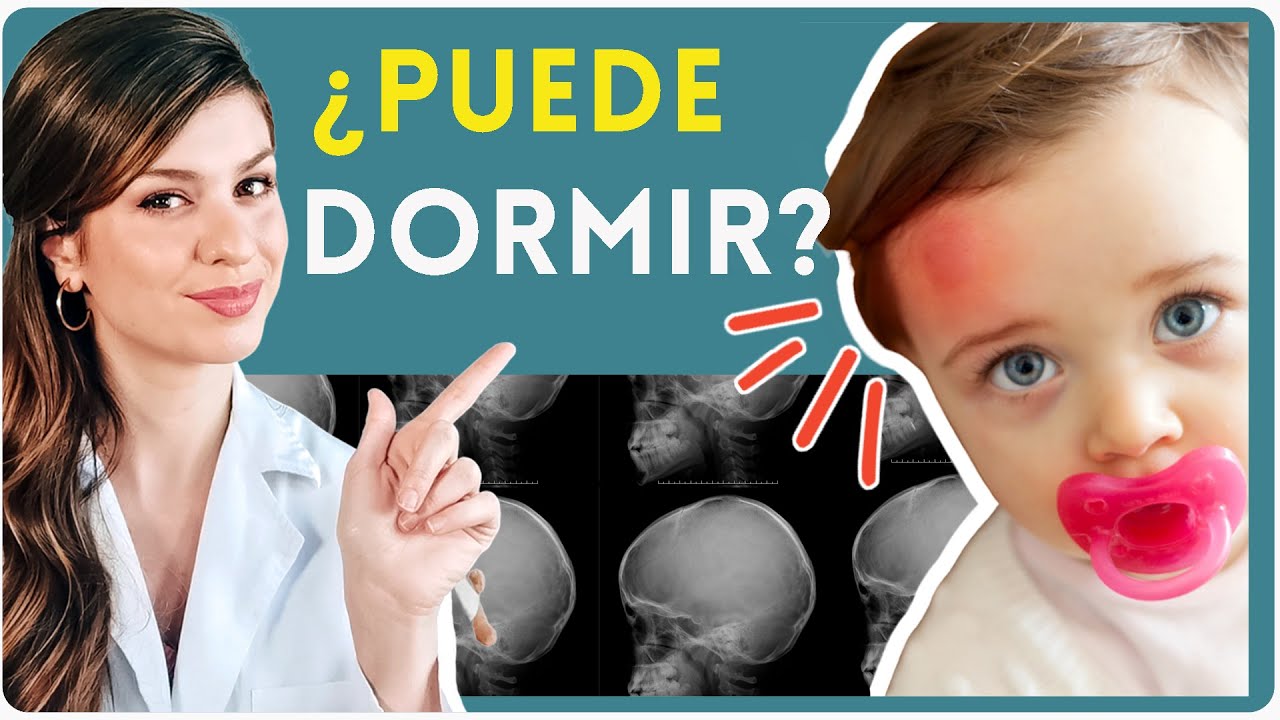 🙆🏻 Golpes En La Cabeza En BEBÉS Y NIÑOS ¿Cómo Actuar? Signos De Alarma ...