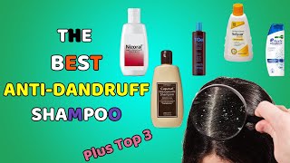 The Best Shampoos To Use For Dandruff | Scalp Dermatitis | Dry \u0026 Itchy Scalp Treatment