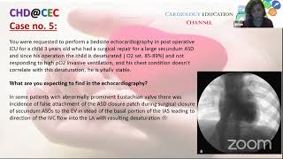 CHD@CEC, Webinar 2, ASD