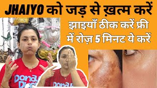 झाइयाँ ख़त्म करें फ्री में | Jhaiyo ko hamesha ke liye theek kare | Melasma Pigmentation Remedy