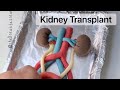 Playdough Surgery - Kidney Transplant