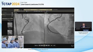 [TCTAP 2024] Live Case \u0026 Lectures 3: CTO